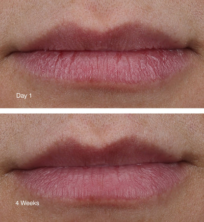 Rhode peptide lip treatment 'watermelon slice'