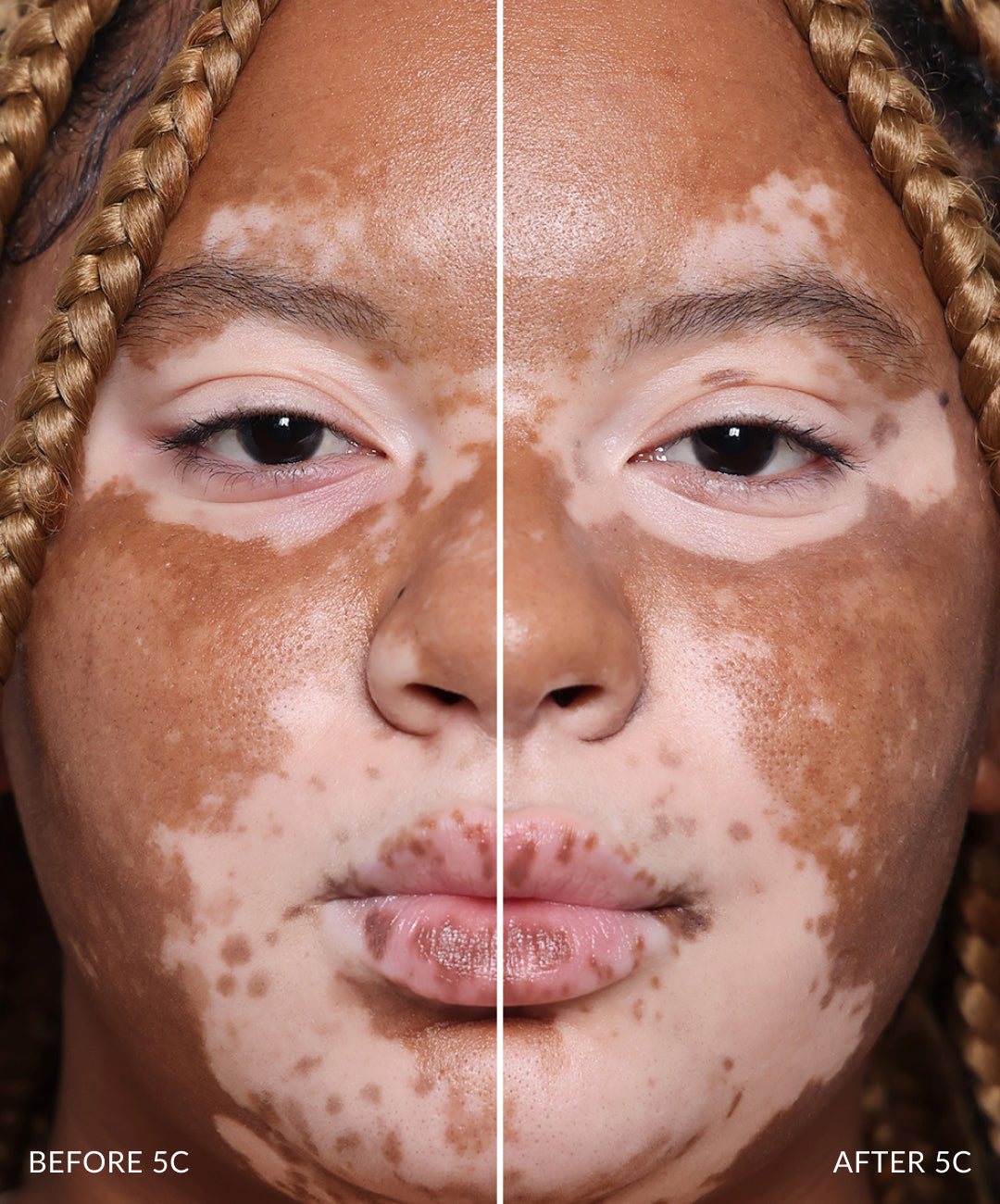 Concealer